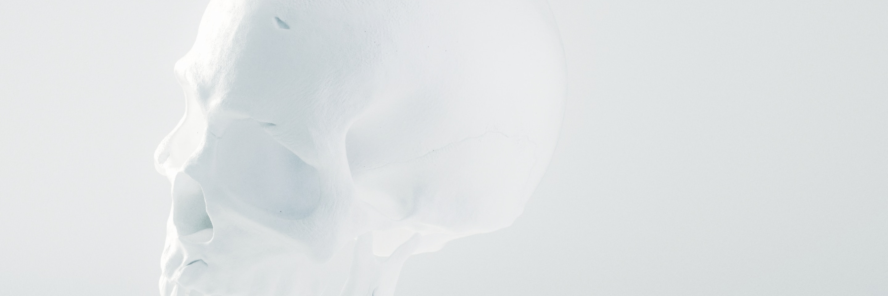 人工頭蓋骨プロテーゼメイン画像