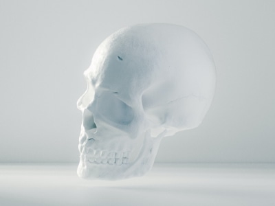 人工頭蓋骨プロテーゼヘッダーナビ画像